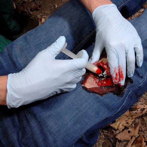 Аппликатор гемостатический с гранулами Rhino Rescue в Ульяновске хитозановый